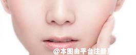 想要做好面部脂肪填充 先要了解好这些情况-4191