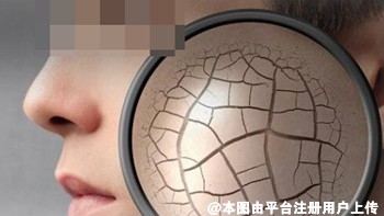 皮肤干燥的时候需要的是保湿而不是补水-4558