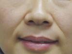 上了年纪的女人 该如何抗衰除皱呢