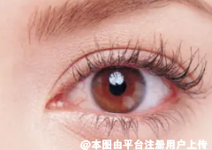 内眦赘皮该如何矫正呢？