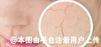 冬季频繁出现皮肤干燥等问题 医美水光补水效果如何