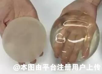 傲诺拉四个系列的隆胸假体有什么区别呢