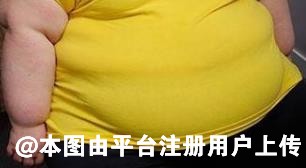 吸脂前一定要避开这些错误的理念
