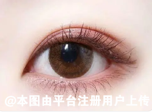 爱美之心人皆有之 做切开双眼皮手术会留疤吗