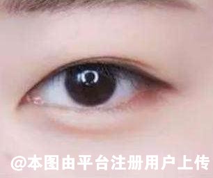怎么才能拥有得一双明亮有神的大眼睛呢