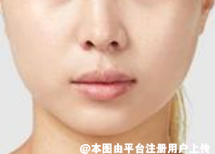 熬夜过后该如何进行皮肤保养呢