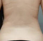 了解一下腹部抽脂减肥手术的相关事项吧