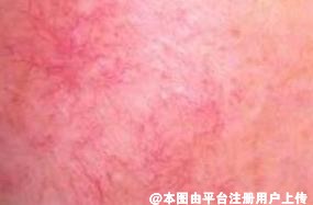 春季护肤攻略很简单 做好这三步就够了