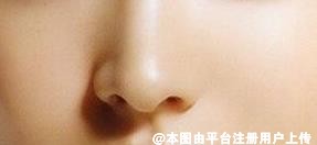 做鼻翼缩小会影响到鼻子正常呼吸吗