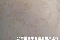 好好的皮肤为啥这么暗淡 这些改善皮肤暗沉方法可以试试