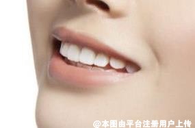 牙齿美白小窍门 让你牙齿干净洁白