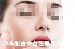 水光注射效果竟然那么多 爱美的你心动了吗