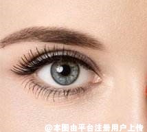 抗衰老篇：眼皮松弛下垂明显该不该做提眉
