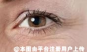 人老眼先衰 维护眼部年轻化很重要