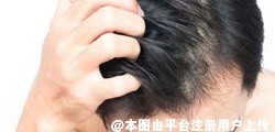 很多人不属于油性的皮肤 但是头发爱出油是暗示体内湿气重吗
