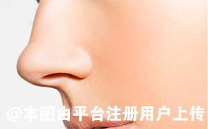 鼻小柱看似不起眼 但其对于鼻子的影响不可低估