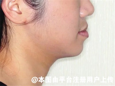下巴决定气质 你的土气是不是下巴惹的祸-25797