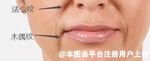 想要改善面中凹陷 这几个简单小方法学起来