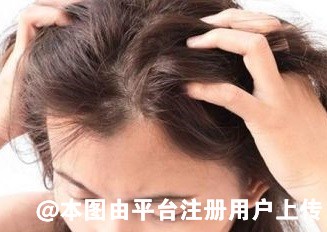 明明是自己头顶的头发就是移植换个位置为啥这么贵