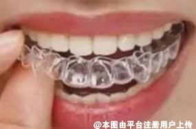 想矫正牙齿 时代天使kid和MRC矫正器怎么选-26093