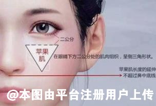 整形科普：哪些脸型适合注射苹果肌 丰苹果肌的方法有哪些