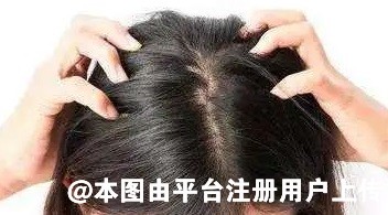为什么头皮上总是长脓包和疙瘩 这4种病要考虑在内