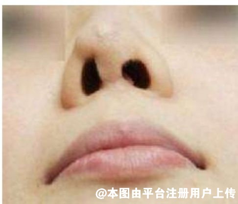 拒绝千篇一律的网红鼻 不同的脸型适合不同的鼻型