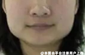 大盘脸也想拥有精致小脸蛋-26691
