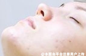 教你如何增厚角质层 修复皮肤屏障功能
