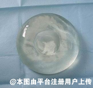 假体隆胸的切口选哪个位置比较好呢