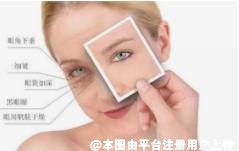 呵护眼周从日常基础护理做起