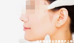 科普：颧骨内推和磨骨差别在那儿呢？