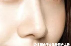 这个暑假抓紧变美 如何拥有一个好看的鼻子呢-27463