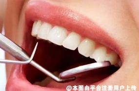 究竟该不该洗牙呢 洗牙的三大偏见