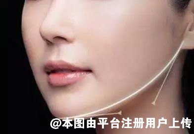 在瘦脸上 瘦脸注射和轮廓注射到底怎么选-28335