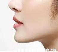 假体垫下巴术 快速拥有侧颜杀