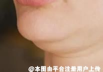 双下巴显得脸大 怎么去双下巴呢