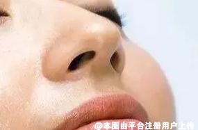 怎么样的鼻型才好看呢  挑选适合的鼻型要先看看这三点-28486