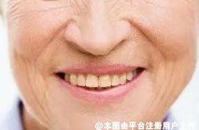 夏天悄悄变美 面部保养安排起来