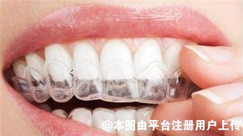 牙套能矫正大小脸型吗