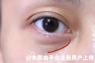说多都是泪 拿什么来拯救我们的泪沟
