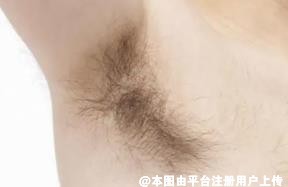 男人味不是腋臭 有腋臭该怎么改善呢