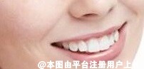 门牙很黄做全瓷贴面要多少钱 若做超薄牙贴面能保持多久