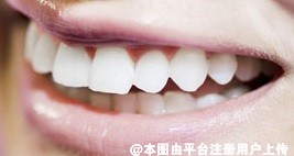 烤瓷牙和全瓷牙的区别哪个好 为什么不建议做全瓷牙