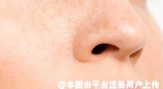 膨体隆鼻与硅胶隆鼻整形哪个更好