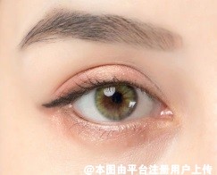 面部衰老三大金刚皱纹 三八纹之泪沟