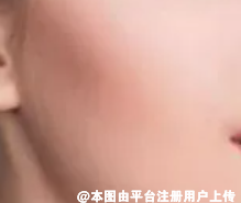 正颌能改善大小脸和脸不对称吗 偏颌如何矫正