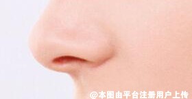 有鼻炎还能进行隆鼻手术吗