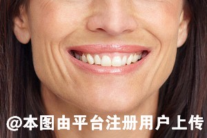 为什么脸会越来越方 有什么方法改善-31732
