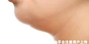 下颌缘和双下巴的位置是不一样的 要学会对症下药